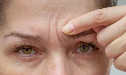 Kolajen Takviyeleri Kırışıklıklar İçin “Mucize Çözüm” Değil