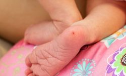 Bebeğin Topuk Kanına Bir Algoritma Bakıyor: İstanbul'da Tarihin En Sessiz Tıp Devrimi