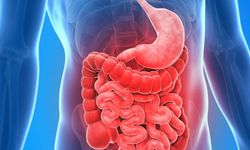 Bağırsak Geçirgenliği (Leaky Gut) Nedir?
