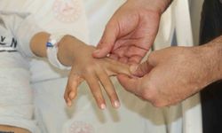 Şırnak'ta Doğuştan Yapışık Parmaklı İki Kardeş Ameliyatla Sağlığına Kavuştu