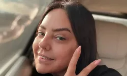 Ebru Gündeş’in Estetik Sonrası Yeni Görüntüsü Gündem Oldu