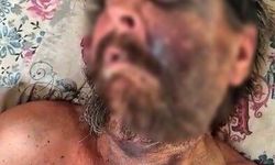 Cenaze nedeniyle saldırıya uğrayan adam ölüme terk edildi