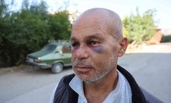 Duyma ve konuşma engelli bireyi dövdüler, ailesi suç duyurusunda bulundu