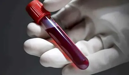 Bu Kan Grubundakiler Daha Az Kalp Krizi Geçiriyor