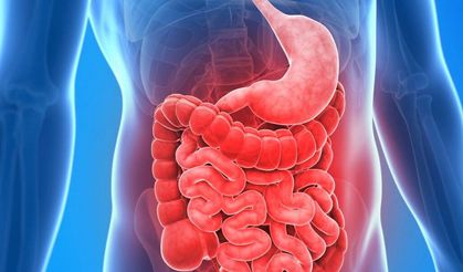 Bağırsak Geçirgenliği (Leaky Gut) Nedir?