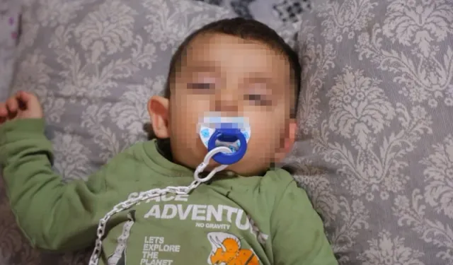 Bebeğin Belinden Zımba Teli Çıktı