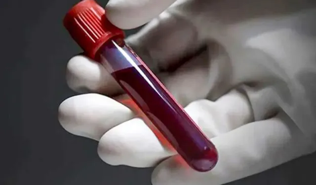 Bu Kan Grubundakiler Daha Az Kalp Krizi Geçiriyor