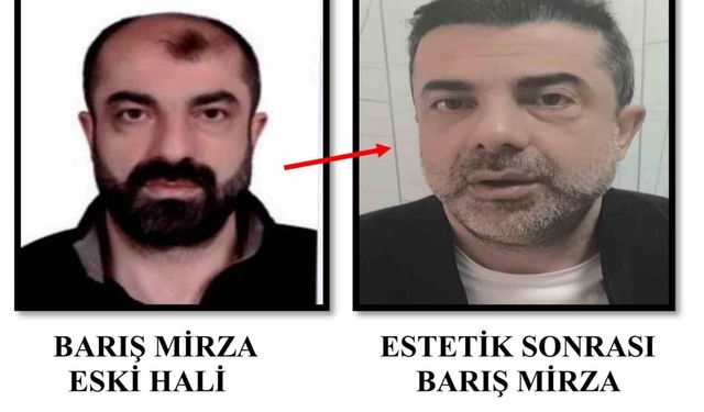 Cinayet azmettiricisi, 7 yıl sonra yüz değiştirmiş halde yakalandı