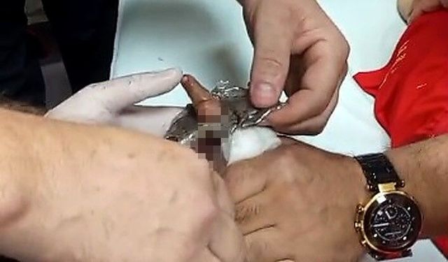 Bitlis'te çelik halkaya parmağı sıkışan çocuk, itfaiye sayesinde kurtarıldı