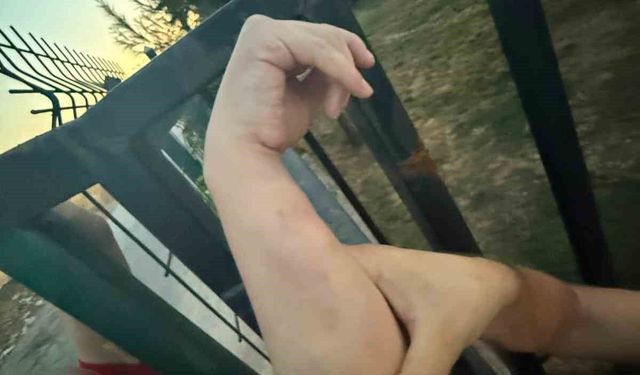 Demir Korkuluğa Sıkışan Vatandaş İtfaiye Tarafından Kurtarıldı