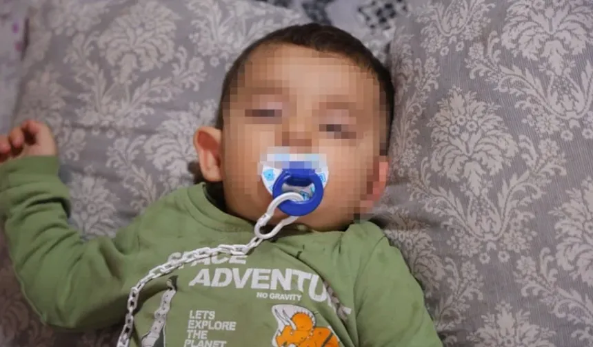 Bebeğin Belinden Zımba Teli Çıktı