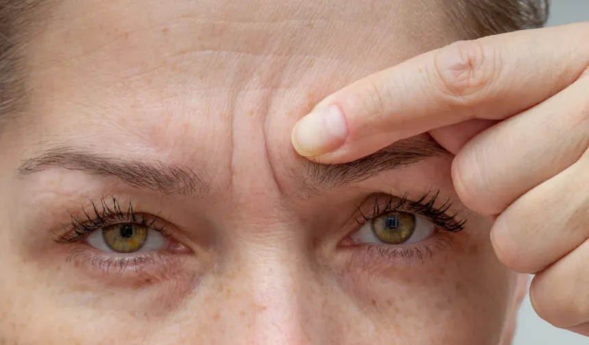 Kolajen Takviyeleri Kırışıklıklar İçin “Mucize Çözüm” Değil